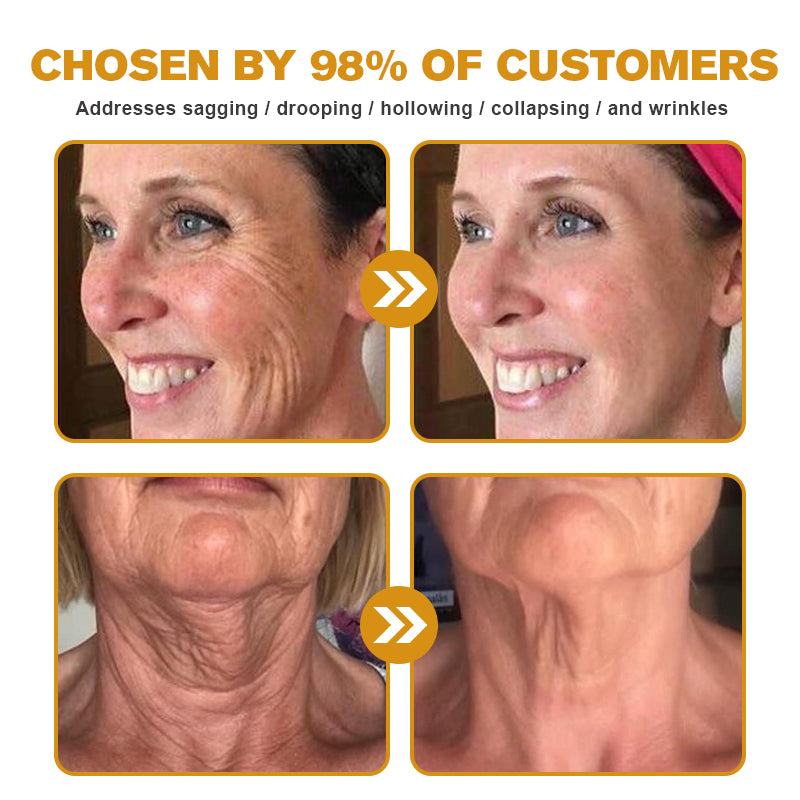 Made in the USA – Furzero™ Botox Bee Venom Wrinkle Removal Cream🇺🇸✨