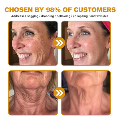 Made in the USA – Furzero™ Botox Bee Venom Wrinkle Removal Cream🇺🇸✨