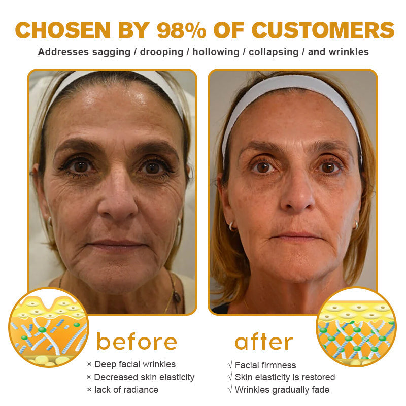 Made in the USA – Furzero™ Botox Bee Venom Wrinkle Removal Cream🇺🇸✨